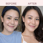 DermaSilk Scar Sheets