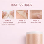 DermaSilk Scar Sheets